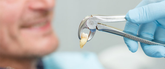 قد لا تراه لكن هذا لا يعني أنه غير موجود.. والأهم، متى يُفترض عليك خلع ضرس العقل؟ صورة رقم 3