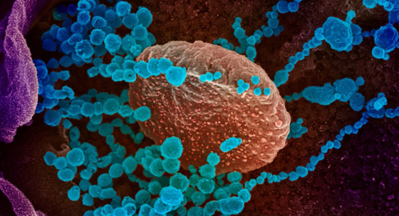 الصحة العالمية تحذر من موجتين ثالثة ورابعة من فيروس كورونا! صورة رقم 5 الصحة العالمية تحذر من موجتين ثالثة ورابعة من فيروس كورونا! صورة رقم 5