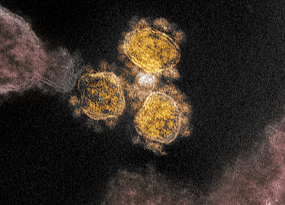 هل تزداد مخاطر كوفيد 19 مع حبوب اللقاح المحمولة جوا في الربيع؟ صورة رقم 8