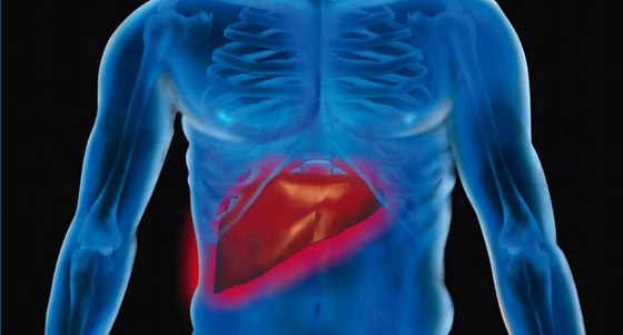 أعراض مرض الكبد الدهني: 6 علامات شائعة لتليّف الكبد! صورة رقم 1