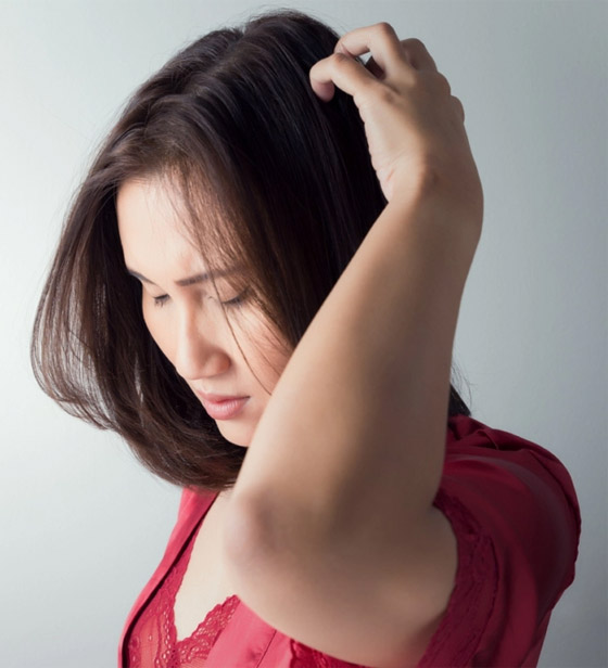 شعركم أيضا قد يؤلمكم.. تعرفوا على مشاكل فروة الرأس وطرق علاجها صورة رقم 2