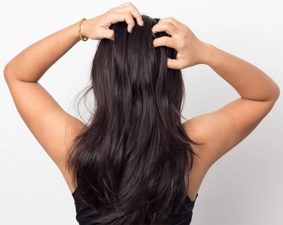 شعركم أيضا قد يؤلمكم.. تعرفوا على مشاكل فروة الرأس وطرق علاجها صورة رقم 5