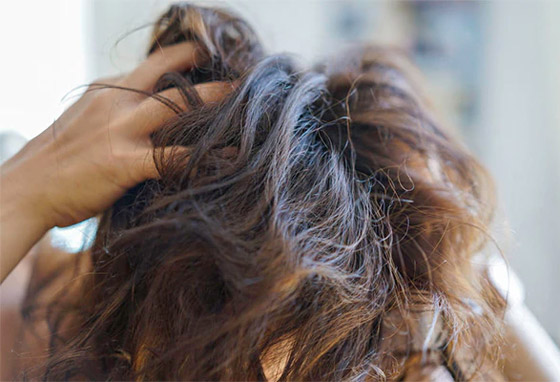 شعركم أيضا قد يؤلمكم.. تعرفوا على مشاكل فروة الرأس وطرق علاجها صورة رقم 6