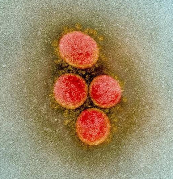 أصل فيروس كورونا.. أخيرا الدراسة المنتظرة تحسم الجدل الطويل! صورة رقم 1