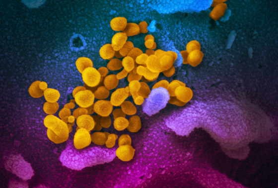 أصل فيروس كورونا.. أخيرا الدراسة المنتظرة تحسم الجدل الطويل! صورة رقم 3