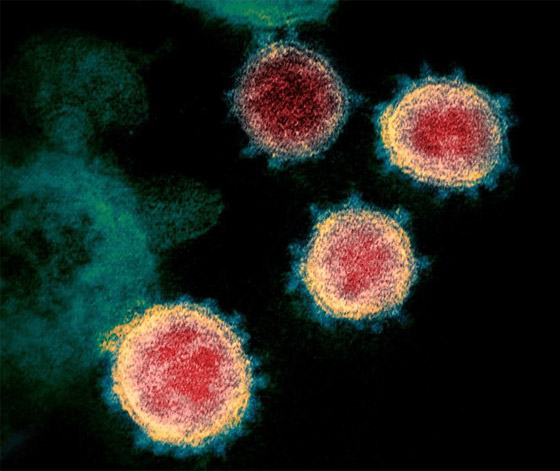 أصل فيروس كورونا.. أخيرا الدراسة المنتظرة تحسم الجدل الطويل! صورة رقم 4