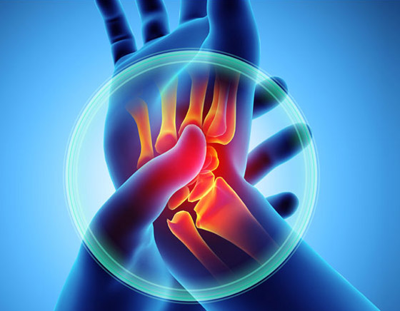 تعاني من أعراض التهاب المفاصل؟ جرِّب هذه العلاجات الطبيعية الفعالة صورة رقم 9