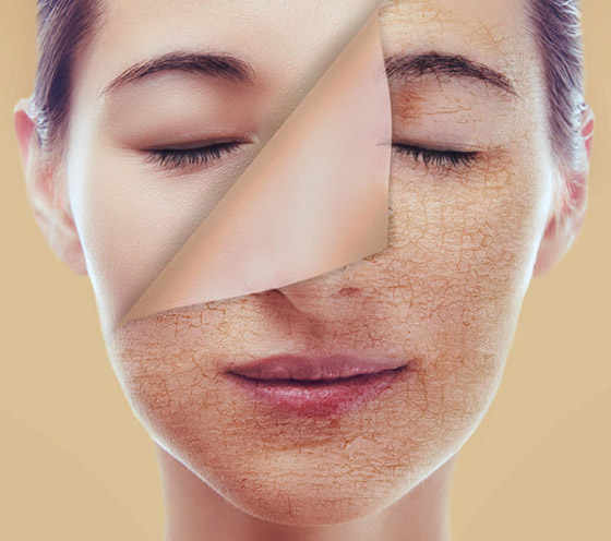 إليكم خطوات ونصائح بسيطة لتعويض جفاف البشرة وعلاجه مع الصيام صورة رقم 3