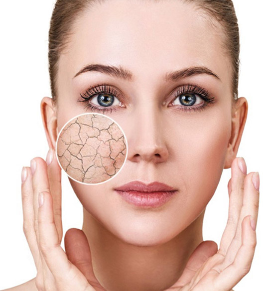 إليكم خطوات ونصائح بسيطة لتعويض جفاف البشرة وعلاجه مع الصيام صورة رقم 9