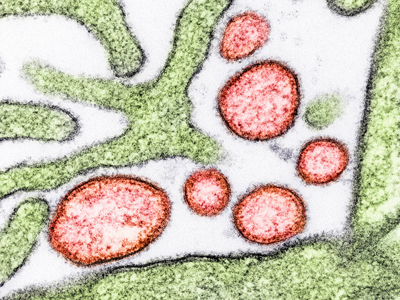 يؤدي للغيبوبة خلال 48 ساعة.. تحذيرات من فيروس نيباه الخطير! صورة رقم 11