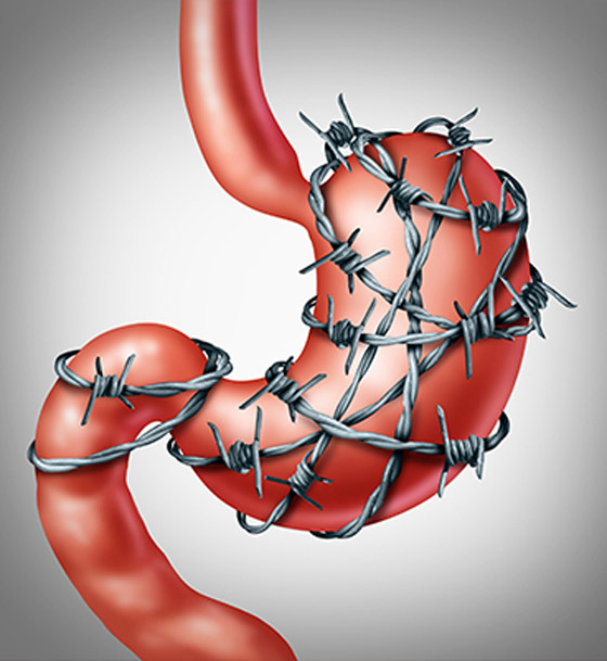 حرقة، إسهال أم إمساك.. 5 نصائح غذائية صحية للتخلص منها! صورة رقم 3