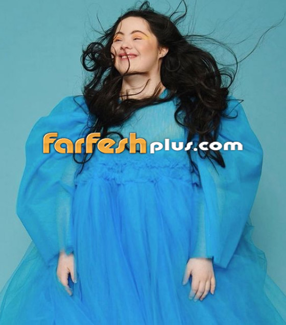 صور: شابة مصابة بمتلازمة داون (المنغولية) تصبح عارضة لـ غوتشي صورة رقم 2