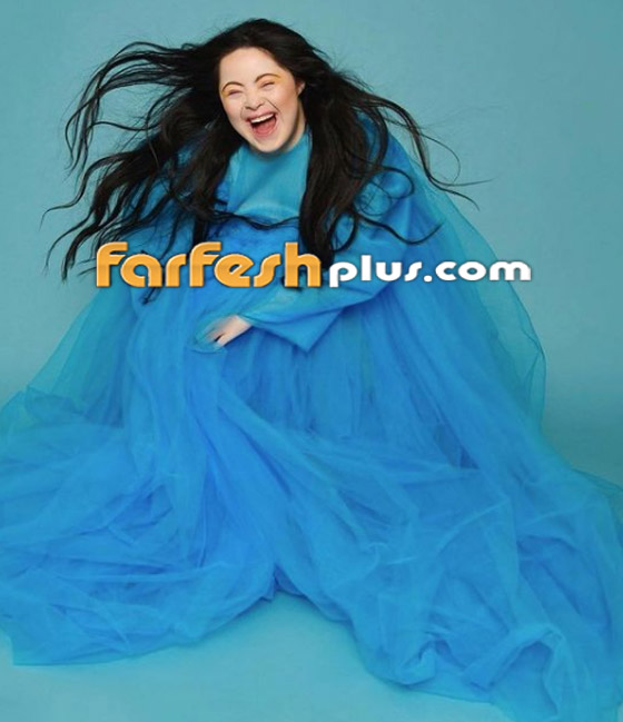 صور: شابة مصابة بمتلازمة داون (المنغولية) تصبح عارضة لـ غوتشي صورة رقم 4