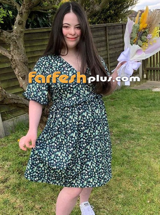 صور: شابة مصابة بمتلازمة داون (المنغولية) تصبح عارضة لـ غوتشي صورة رقم 7