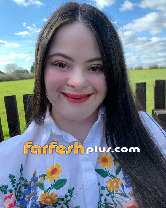 صور: شابة مصابة بمتلازمة داون (المنغولية) تصبح عارضة لـ غوتشي صورة رقم 8