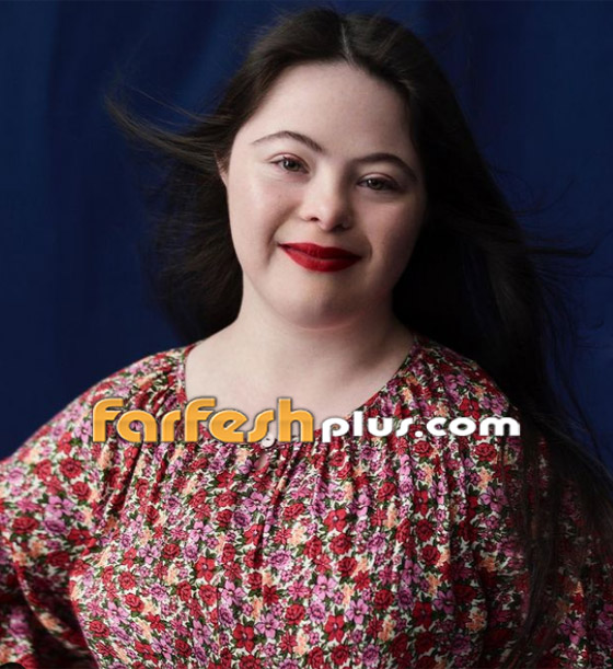 صور: شابة مصابة بمتلازمة داون (المنغولية) تصبح عارضة لـ غوتشي صورة رقم 9