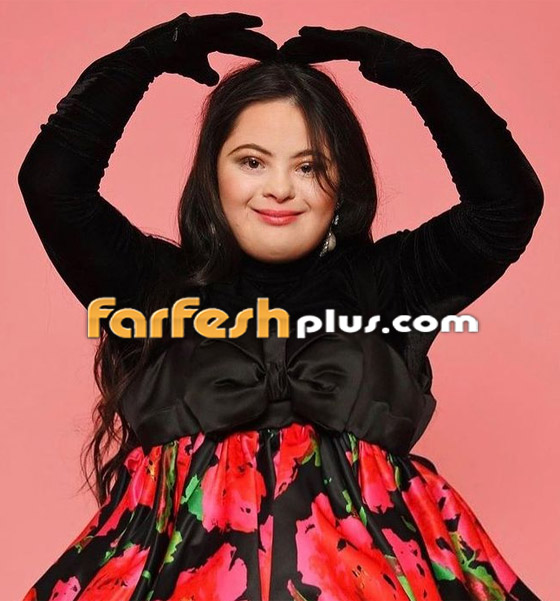 صور: شابة مصابة بمتلازمة داون (المنغولية) تصبح عارضة لـ غوتشي صورة رقم 10