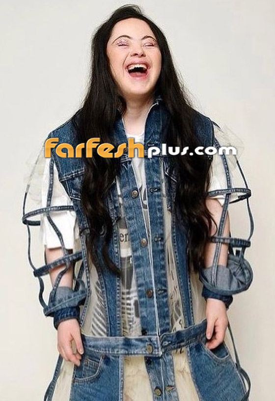 صور: شابة مصابة بمتلازمة داون (المنغولية) تصبح عارضة لـ غوتشي صورة رقم 11