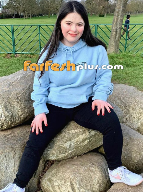 صور: شابة مصابة بمتلازمة داون (المنغولية) تصبح عارضة لـ غوتشي صورة رقم 13