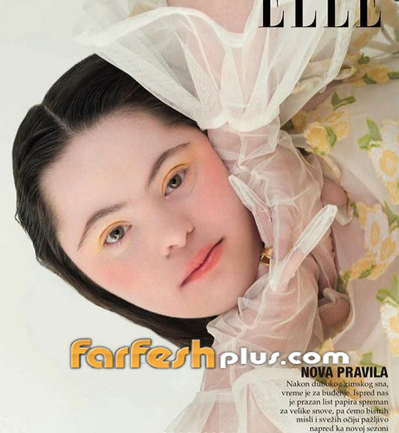 صور: شابة مصابة بمتلازمة داون (المنغولية) تصبح عارضة لـ غوتشي صورة رقم 12