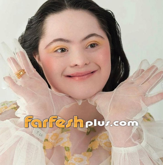 صور: شابة مصابة بمتلازمة داون (المنغولية) تصبح عارضة لـ غوتشي صورة رقم 14