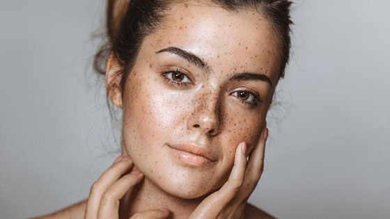 للعروس: قناع الفجل للتخلص من النمش صورة رقم 2