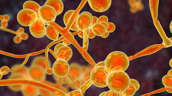 يصيب المناعة الضعيفة.. كل ما تريدون معرفته عن عدوى الفطر الأصفر صورة رقم 4