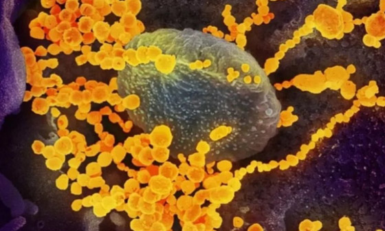 يصيب المناعة الضعيفة.. كل ما تريدون معرفته عن عدوى الفطر الأصفر صورة رقم 8