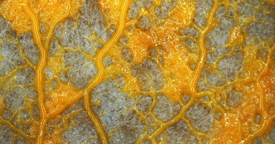 يصيب المناعة الضعيفة.. كل ما تريدون معرفته عن عدوى الفطر الأصفر صورة رقم 9