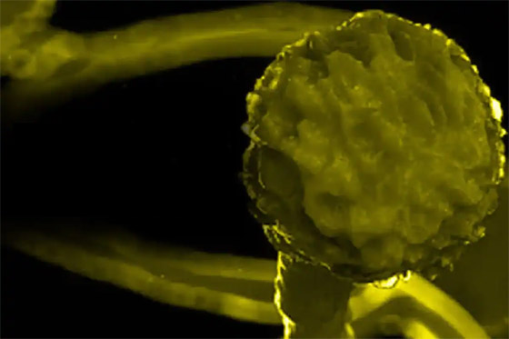 يصيب المناعة الضعيفة.. كل ما تريدون معرفته عن عدوى الفطر الأصفر صورة رقم 11