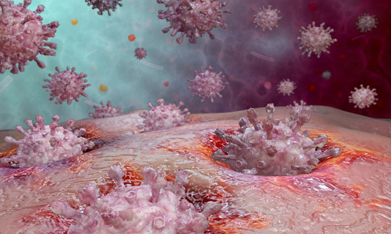 تعرفوا إلى 5 أوبئة وفيروسات شهيرة أرّقت العالم خلال العقد الماضي صورة رقم 3