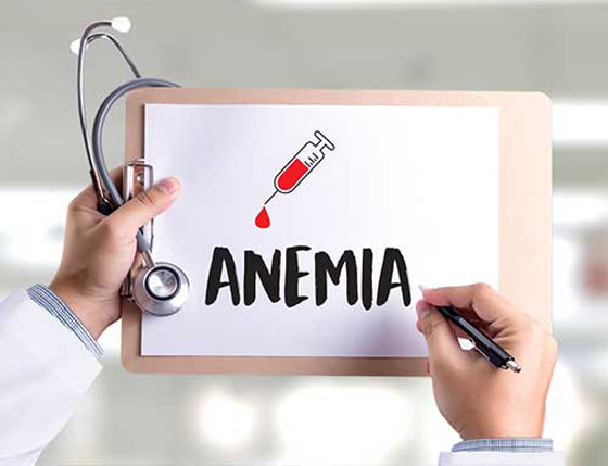 إليكم علاجات منزلية فعالة لعلاج فقر الدم بسرعة صورة رقم 7