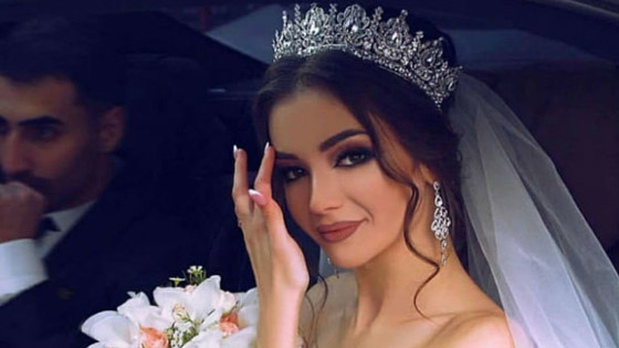 لعروس 2021: نصائح العناية بالبشرة الدهنية في الصيف صورة رقم 4