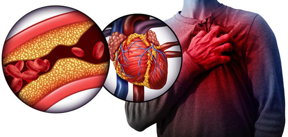 اشربوا المشروب الساخن أثناء الطقس الحار.. 8 حقائق صحية ستذهلكم! صورة رقم 3 اشربوا المشروب الساخن أثناء الطقس الحار.. 8 حقائق صحية ستذهلكم! صورة رقم 3