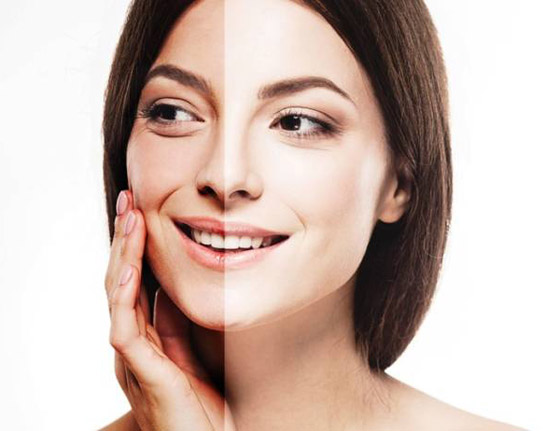 إليكم أفضل ماسك لإزالة آثار حروق الشمس صورة رقم 3