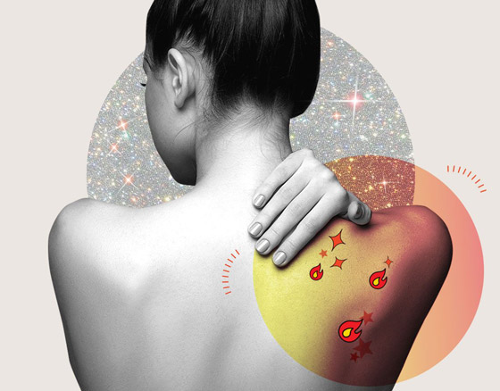 إليكم أفضل ماسك لإزالة آثار حروق الشمس صورة رقم 5