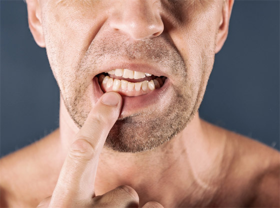 قد تدل على مشكلة صحية خطيرة.. ما أسباب حساسية اللثة وطرق علاجها؟ صورة رقم 3 قد تدل على مشكلة صحية خطيرة.. ما أسباب حساسية اللثة وطرق علاجها؟ صورة رقم 3