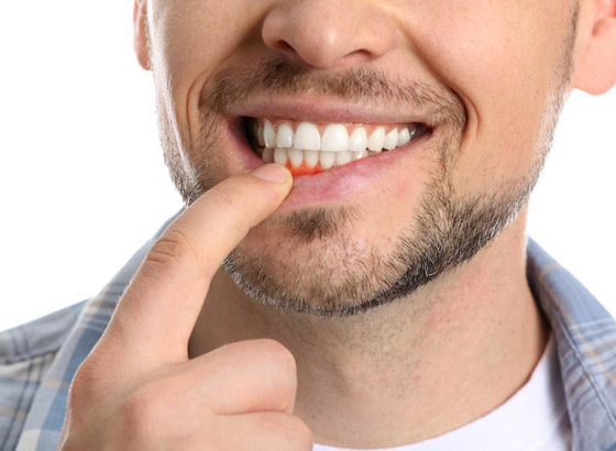 قد تدل على مشكلة صحية خطيرة.. ما أسباب حساسية اللثة وطرق علاجها؟ صورة رقم 9 قد تدل على مشكلة صحية خطيرة.. ما أسباب حساسية اللثة وطرق علاجها؟ صورة رقم 9