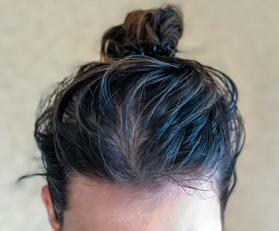 مأساة الشعر الدهني بالصيف.. 7 نصائح للتعامل مع فروات الرؤوس المتعرقة صورة رقم 4 مأساة الشعر الدهني بالصيف.. 7 نصائح للتعامل مع فروات الرؤوس المتعرقة صورة رقم 4