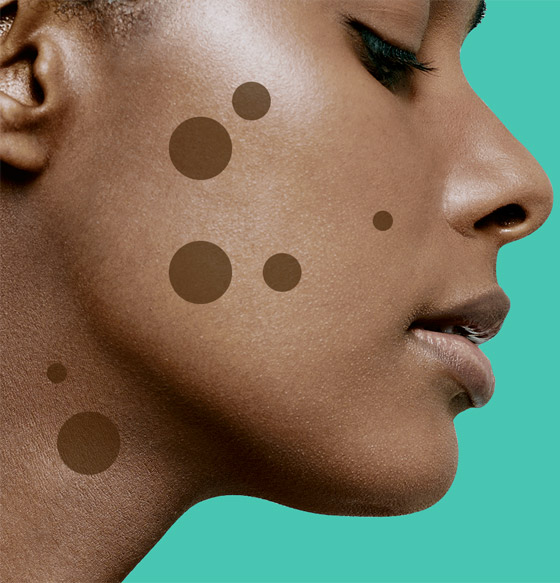 إليكم 5 طرق لتفتيح البقع الداكنة بالوجه والجسم قبل العيد صورة رقم 6