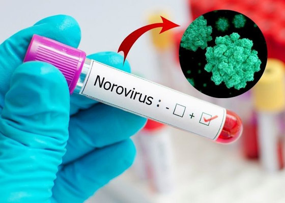 الآثار الجانبية لرفع قيود كورونا: تفشي فيروس جديد أشد عدوى! صورة رقم 2