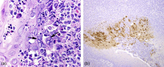 الصين تسجل أول وفاة بشرية بفيروس جدري القردة.. مرض نادر ولا لقاح له صورة رقم 8
