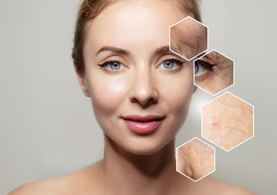 9 أطعمة تؤدي إلى شيخوخة البشرة! احذروا منها لتكتسبوا النضارة والشباب صورة رقم 10