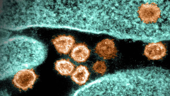 عالم روسي يصدم البشرية: الجسم يشيخ عاماً عن كل يوم إصابة بكورونا صورة رقم 3 عالم روسي يصدم البشرية: الجسم يشيخ عاماً عن كل يوم إصابة بكورونا صورة رقم 3