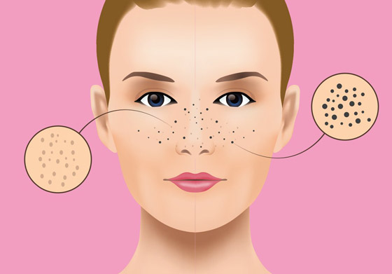 3 أسلحة لمحاربة الرؤوس السوداء صورة رقم 1