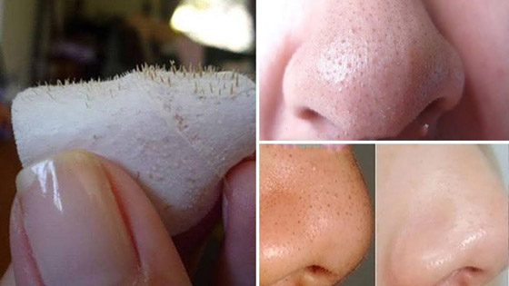 3 أسلحة لمحاربة الرؤوس السوداء صورة رقم 3