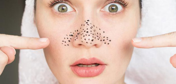 3 أسلحة لمحاربة الرؤوس السوداء صورة رقم 4