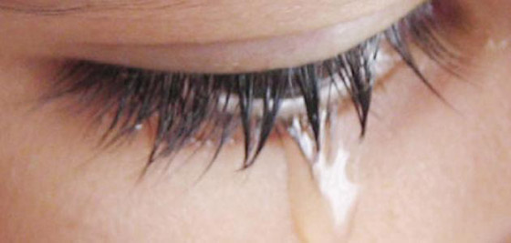 4 أسباب لتساقط الدموع اللاإرادي صورة رقم 5