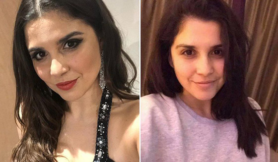 صور: بريطانية تنافس على لقب ملكة جمال دون استخدام مساحيق تجميل صورة رقم 3