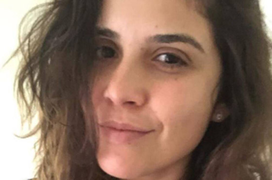 صور: بريطانية تنافس على لقب ملكة جمال دون استخدام مساحيق تجميل صورة رقم 10